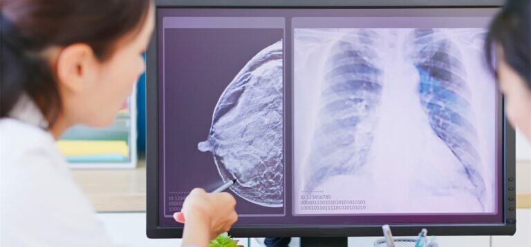 Early Signs of Cancer: 18 Symptoms You Shouldn’t Ignore