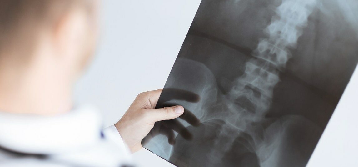 legal rights following spinal injuries and accidents